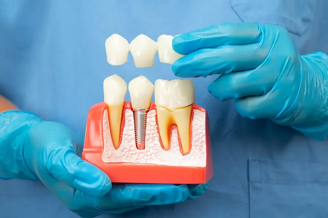 Punte dentara la Smile City