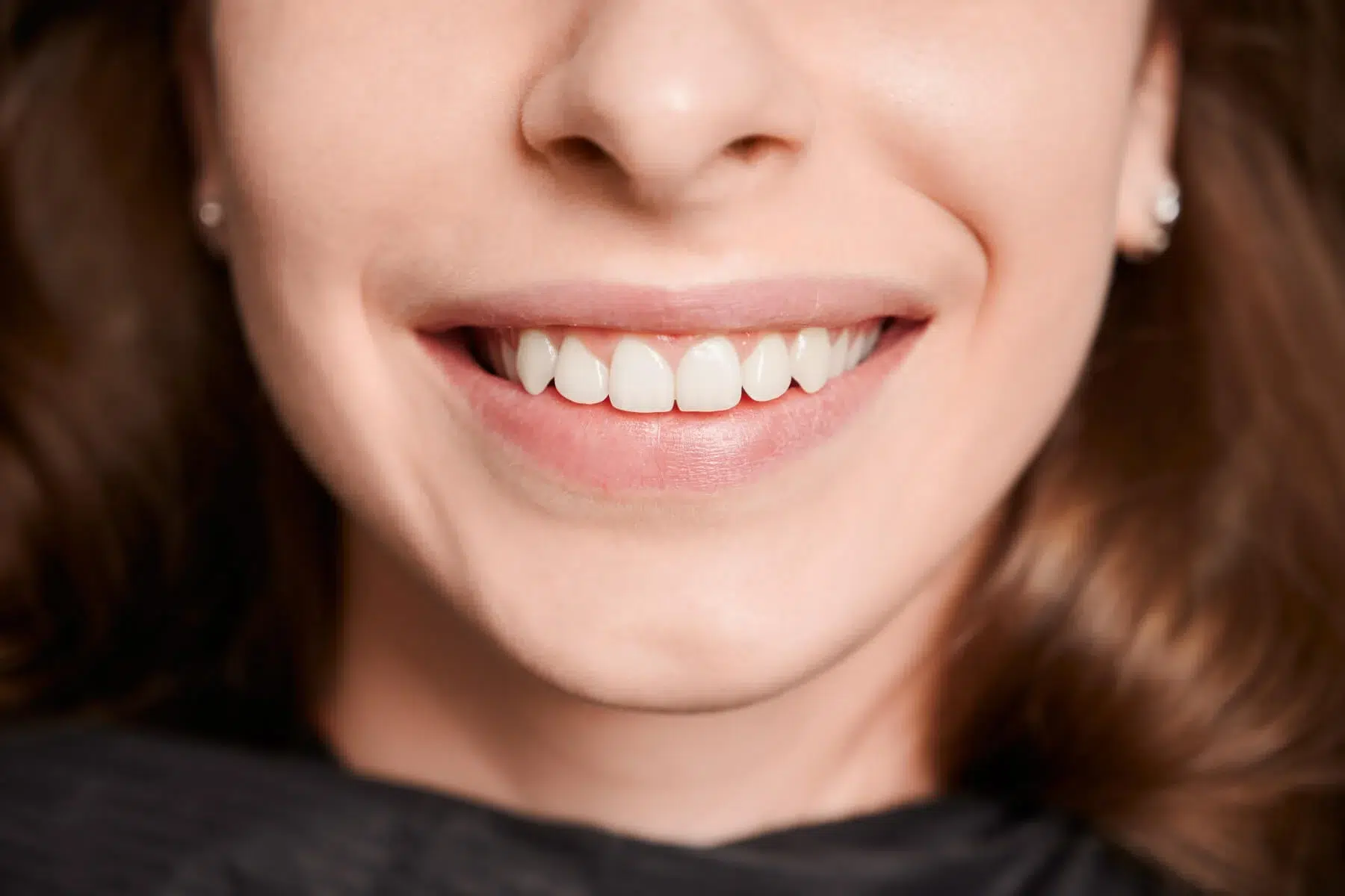 albire dinti profesionala cu laser in cabinetul unui dentist