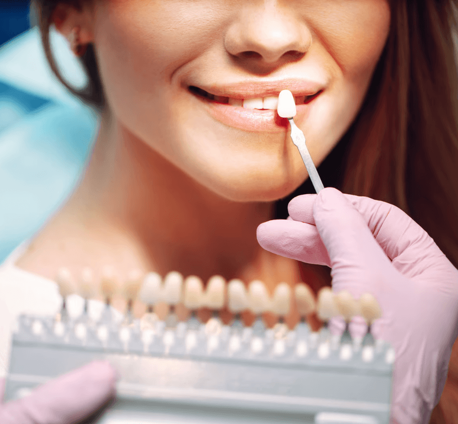 Alegerea fatetelor dentare in sector 6 bucuresti