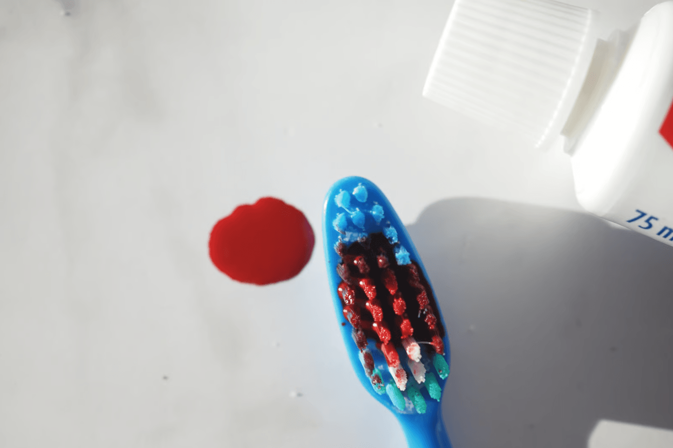 Articol despre sangerarile gingivale